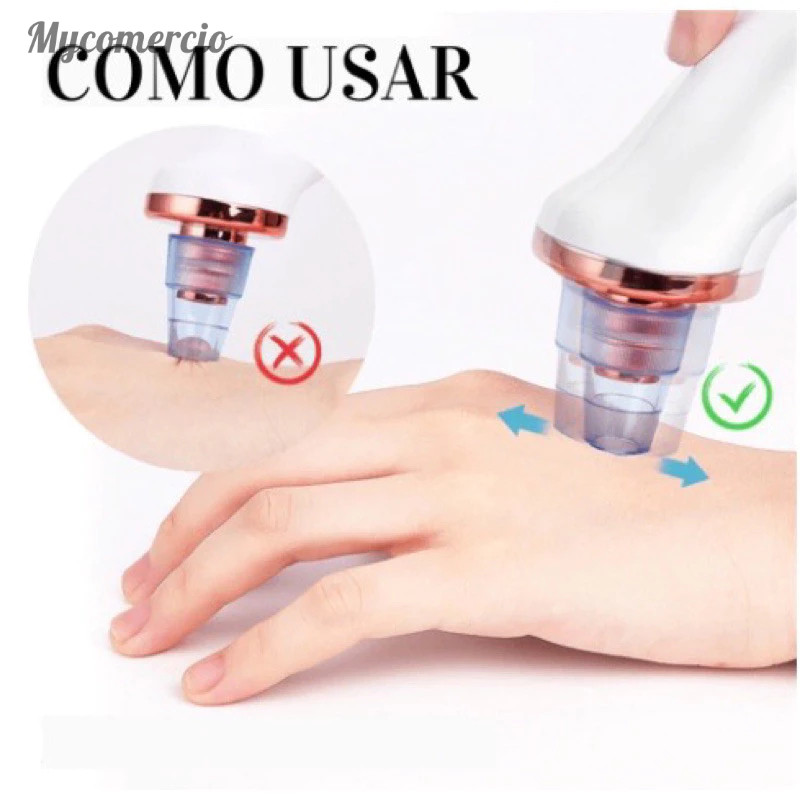 Removedor Cravos e Espinhas Extrator de Cravos Sucção a Vácuo Aparelho Recarregável Sugador Remove Acne